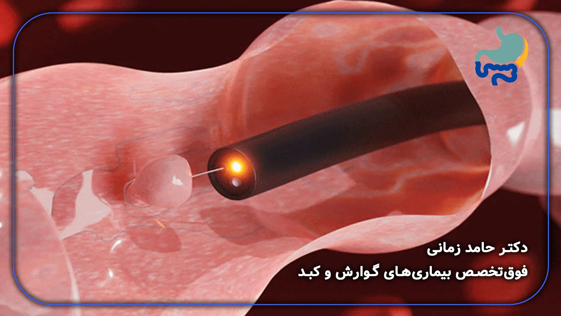 امادگی برای کولونوسکوپی