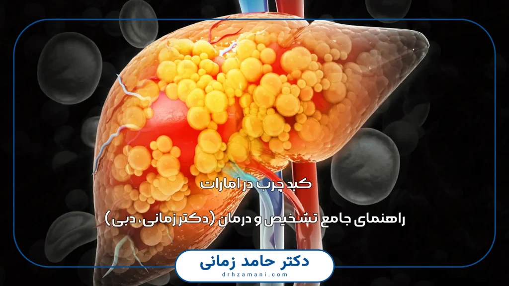 رژیم مدیترانهای برای کبد چرب | برنامه غذایی، غذاهای مجاز و ممنوع